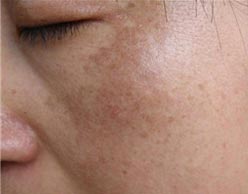 ����Qɫ�ؼ�������ҩ������Ĥ