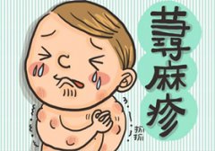 荨麻疹该怎么防备呢